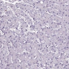 Immunohistochemical staining of human liver shows negative positivity in hepatocytes.