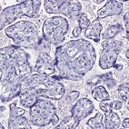 Immunohistochemical staining of human placenta shows negative positivity in trophoblastic cells.