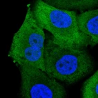 Immunofluorescent staining of human cell line A549 shows localization to plasma membrane & cytosol.
