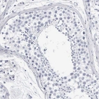 Immunohistochemical staining of human testis shows no positivity in cells in seminiferous ducts.