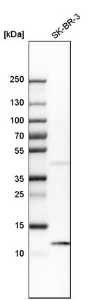 Western blot analysis in human cell line SK-BR-3.
