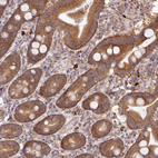Immunohistochemical staining of human duodenum shows moderate cytoplasmic-membranous positivity in glandular cells.