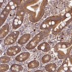 Immunohistochemical staining of human duodenum shows moderate cytoplasmic-membranous positivity in glandular cells.