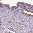 Immunohistochemical staining of human fallopian tube shows moderate cytoplasmic-membranous positivity in glandular cells.