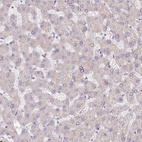 Immunohistochemical staining of human liver shows no positivity in hepatocytes.