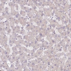 Immunohistochemical staining of human liver shows no positivity in hepatocytes.
