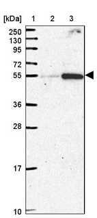 Lane 1: Marker [kDa] 250, 130, 95, 72, 55, 36, 28, 17, 10_br/_Lane 2: Human cell line RT-4_br/_Lane 3: Human cell line U-251MG sp