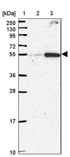 Lane 1: Marker [kDa] 250, 130, 95, 72, 55, 36, 28, 17, 10_br/_Lane 2: Human cell line RT-4_br/_Lane 3: Human cell line U-251MG sp