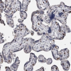 Immunohistochemical staining of human placenta shows strong nuclear positivity in subset of endothelial cells.