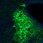 Anti-TH Antibody