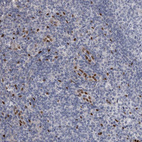 Immunohistochemical staining of human tonsil tissue shows moderate nuclear positivity in subset of endothelial cells.
