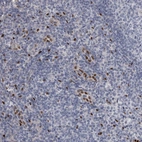Immunohistochemical staining of human tonsil tissue shows moderate nuclear positivity in subset of endothelial cells.