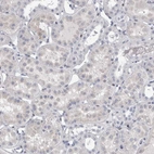 Immunohistochemical staining of human kidney shows very weak nuclear positivity in cells in tubules.