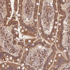 Immunohistochemical staining of human duodenum shows moderate cytoplasmic/cytoplasmic granular positivity in glandular cells.