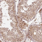 Immunohistochemical staining of human testis shows moderate cytoplasmic positivity in cells in seminiferous ducts and Leydig cells.