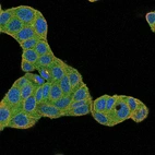Anti-ZYG11B Antibody