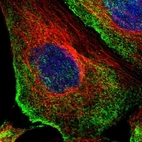 Immunofluorescent staining of human cell line A-431 shows localization to plasma membrane.
