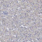 Immunohistochemical staining of human liver shows weak cytoplasmic positivity in subset of hepatocytes.