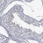 Immunohistochemical staining of human testis shows moderate cytoplasmic positivity in subset of cells in seminiferous ducts.