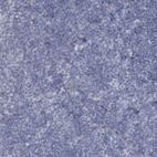 Immunohistochemical staining of human tonsil tissue shows no positivity in non-germinal center cells.