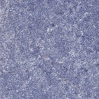 Immunohistochemical staining of human tonsil tissue shows no positivity in non-germinal center cells.