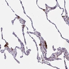 Immunohistochemical staining of human lung shows strong cytoplasmic positivity in subset of macrophages.