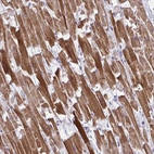 Immunohistochemical staining of human heart muscle shows strong cytoplasmic positivity in cardiomyocytes.