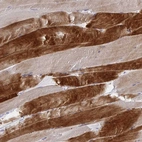 Immunohistochemical staining of human skeletal muscle shows strong cytoplasmic positivity in subset of myocytes.