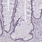 Immunohistochemical staining of human rectum shows no positivity in glandular cells.
