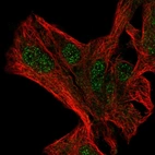 Immunofluorescent staining of human cell line Hep G2 shows localization to nucleoplasm.