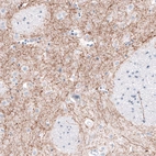 Immunohistochemical staining of human caudate nucleus shows moderate to strong positivity in monoaminergic neural fibers.