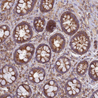 Immunohistochemical staining of human rectum shows moderate membranous-cytoplasmic positivity in glandular cells.