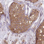 Immunohistochemical staining of human testis shows moderate membranous-cytoplasmic positivity in cells in seminiferous ducts.