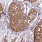 Immunohistochemical staining of human testis shows moderate membranous-cytoplasmic positivity in cells in seminiferous ducts.