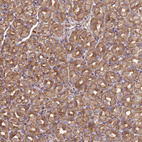 Immunohistochemical staining of human stomach shows moderate membranous-cytoplasmic positivity in glandular cells.