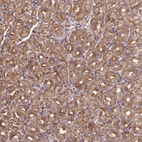 Immunohistochemical staining of human stomach shows moderate membranous-cytoplasmic positivity in glandular cells.