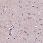 Immunohistochemical staining of human cerebral cortex shows weak positivity in cytoplasm granular in neurons.