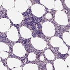 Immunohistochemical staining of human bone marrow shows moderate cytoplasmic positivity in hematopoietic cells.