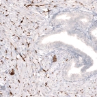 Immunohistochemical staining of human prostate shows strong positivity in sympathetic peripheral nerves.