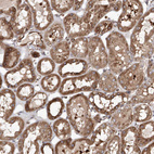 Immunohistochemical staining of human kidney shows strong cytoplasmic/cytoplasmic membranous positivity in cells in tubules.