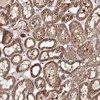 Immunohistochemical staining of human kidney shows strong cytoplasmic/cytoplasmic membranous positivity in cells in tubules.