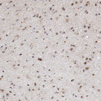 Immunohistochemical staining of human cerebral cortex shows moderate cytoplasmic/cytoplasmic membranous positivity in neuronal cells.