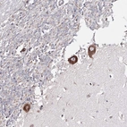 Immunohistochemical staining of human cerebellum shows strong cytoplasmic positivity in Purkinje cells.