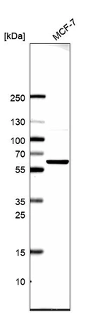 Western blot analysis in human cell line MCF-7.