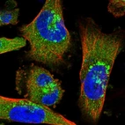 Immunofluorescent staining of human cell line U-251 MG shows localization to cytosol, the Golgi apparatus & vesicles.