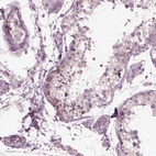 Immunohistochemical staining of human testis shows weak membranous and cytoplasmic positivity in spermatogonia.