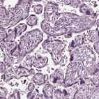 Immunohistochemical staining of human placenta shows no positivity in trophoblastic cells as expected.