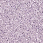 Immunohistochemical staining of human liver shows no positivity in hepatocytes as expected.
