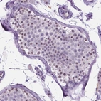 Immunohistochemical staining of human testis shows moderate positivity in nucleoli in cells in seminiferous ducts.