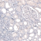 Immunohistochemical staining of human kidney shows no positivity in cells in tubules as expected.